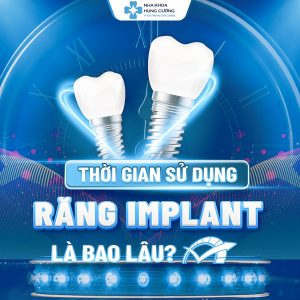 Trồng răng Implant có sử dụng vĩnh viễn được không?