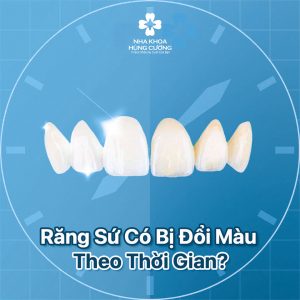 Răng sứ có bị đổi màu theo thời gian?