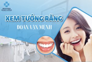 Xem tướng răng đoán vận mệnh