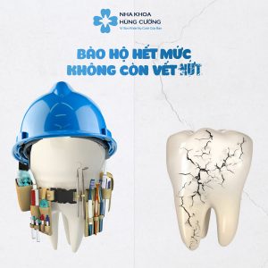 Cách đánh răng đúng cách khi niềng răng
