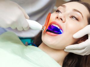 Công nghệ tẩy trắng răng có gây hại hay không?