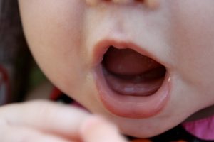 Cách chăm sóc bé sốt khi mọc răng