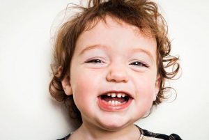 Răng sữa ở trẻ có thể là dấu hiệu cảnh báo rối loạn tâm thần