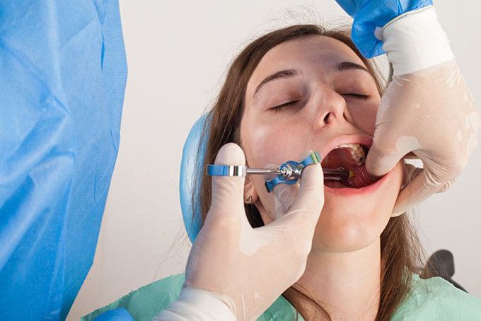 Nhổ răng hàm liệu có nguy hiểm? Chăm sóc sau nhổ răng hàm