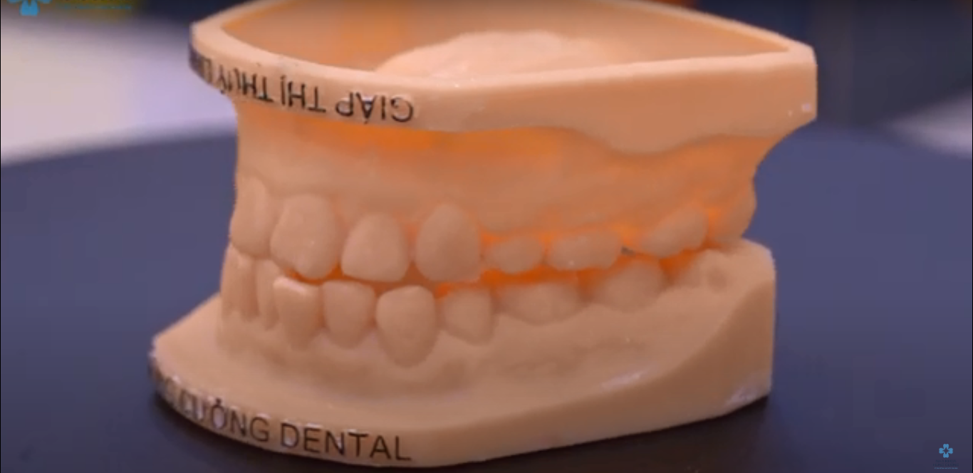 Phòng Cad/cam của Nha khoa Hùng Cường có gì đặc biệt?