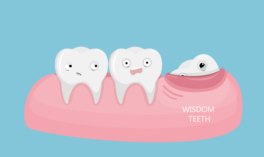 Răng khôn – Khôn hay dại?